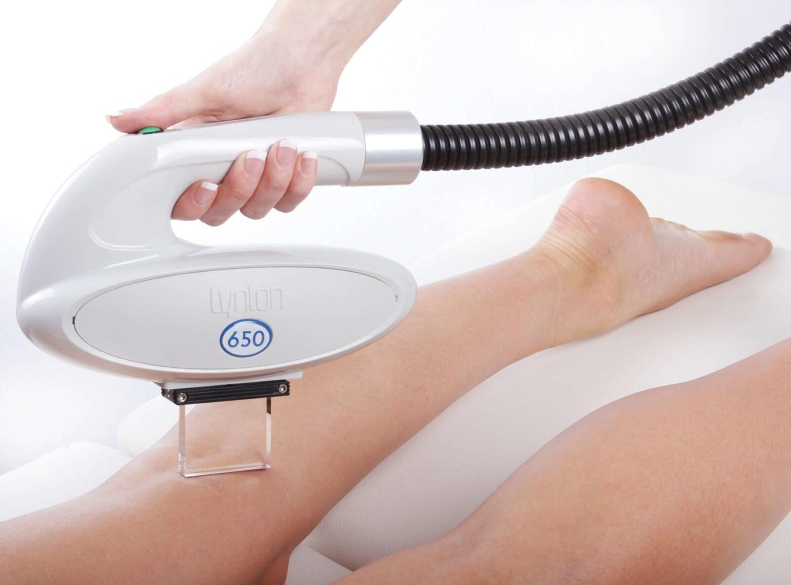 IPL Hair Removal